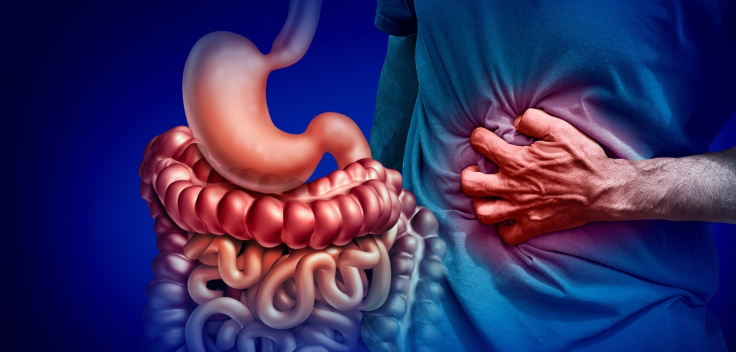 Crohn’s Disease Infusions: What to Know About Treatment Options